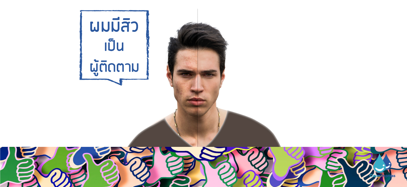 มาดูกันสาเหตุก่อสิว ที่คุณอาจไม่เคยรู้ มาดูกันสาเหตุก่อสิว ที่คุณอาจไม่เคยรู้
